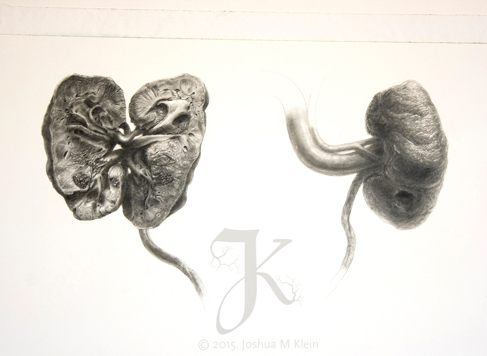 Carbon dust illustration of cadaveric kidneys, renal anatomy study