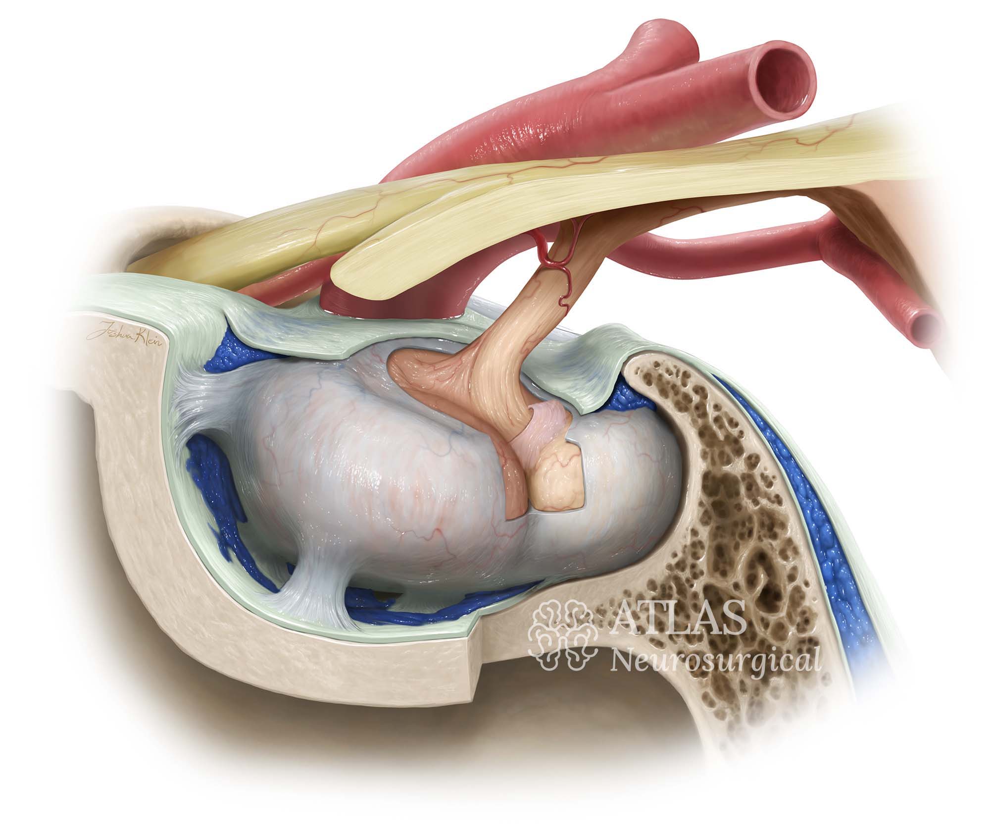 Medical illustration of pituitary dural layers